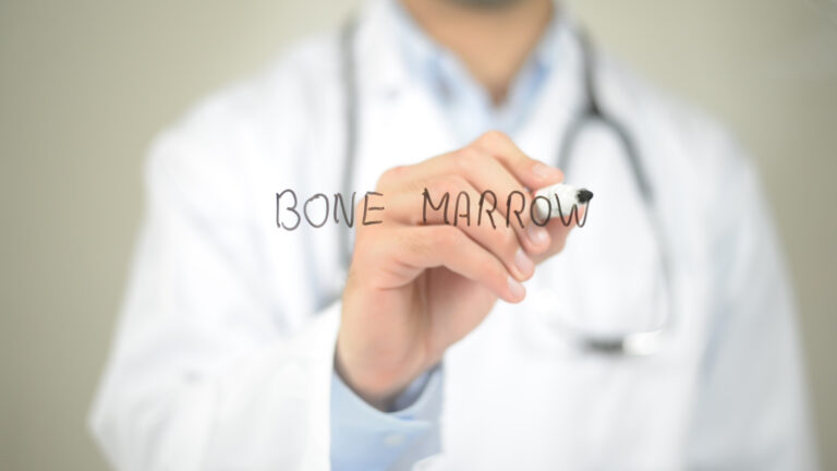 Myths and Facts About Bone Marrow Cell Therapy