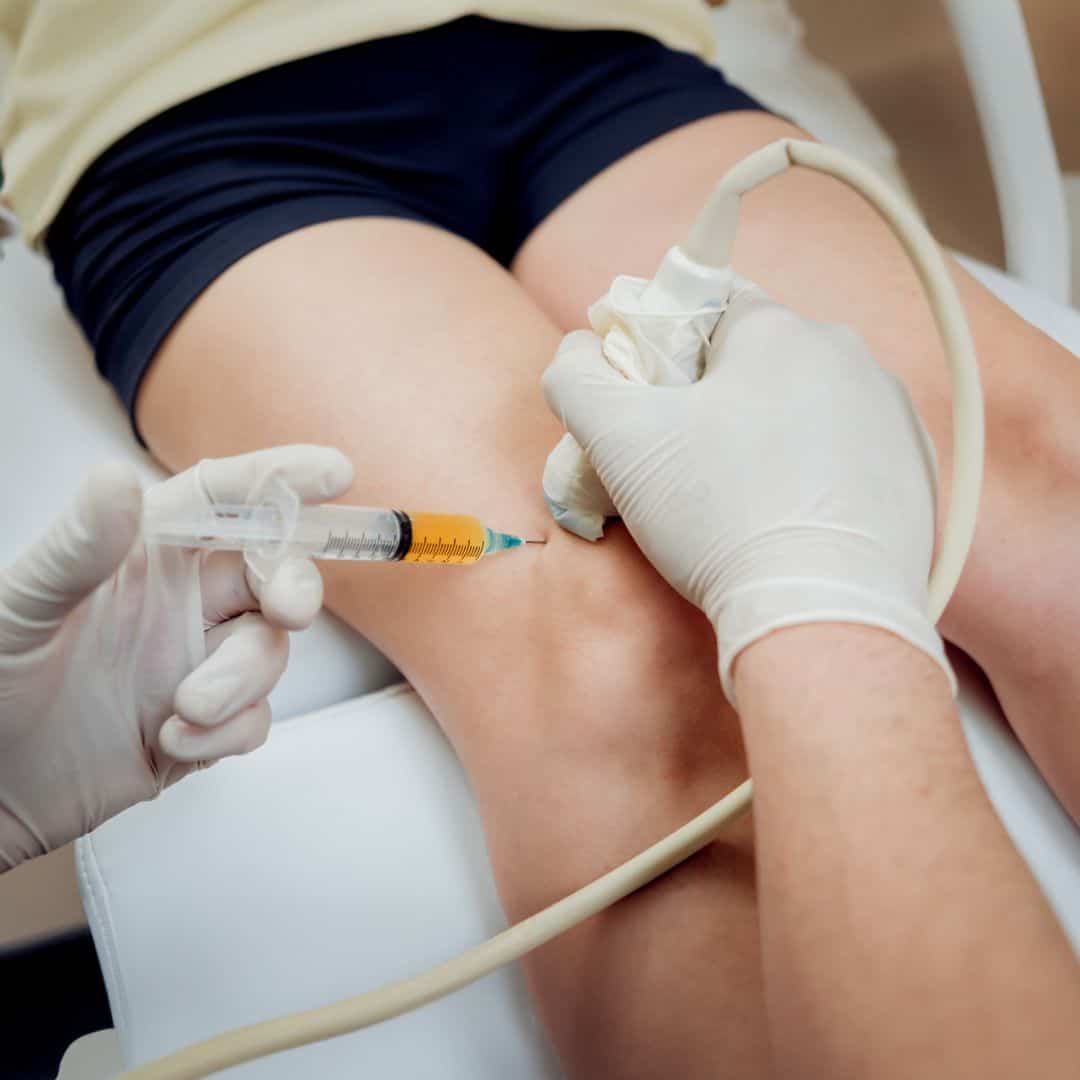 PRP Knee Injection