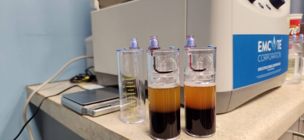 platelet-rich plasma